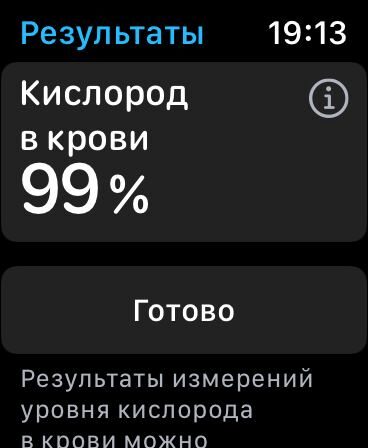 Первый взгляд: обзор Apple Watch series 6 cо сканером кислорода в крови 32 Камера periscope на Xiaomi 17 Ultra крупным планом