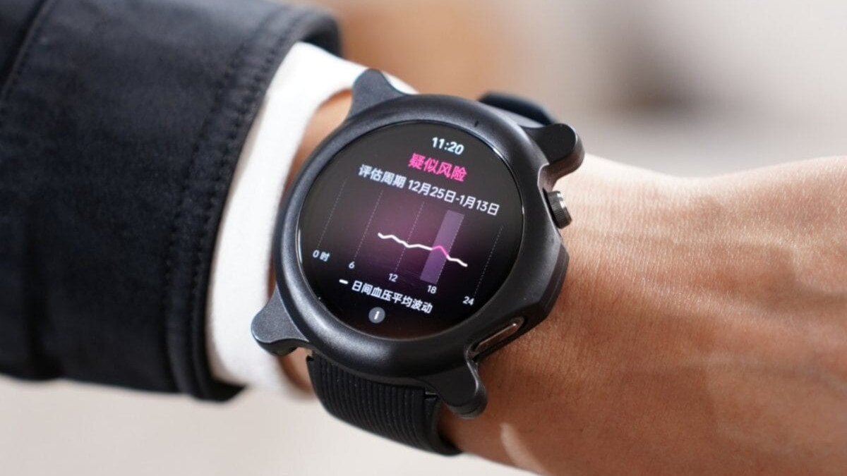 Часы OPPO Watch X2 получат функцию мониторинга АД 2 OPPO Watch X2