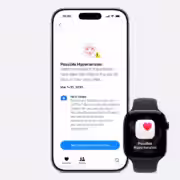 apple watch series 11 18.jpeg