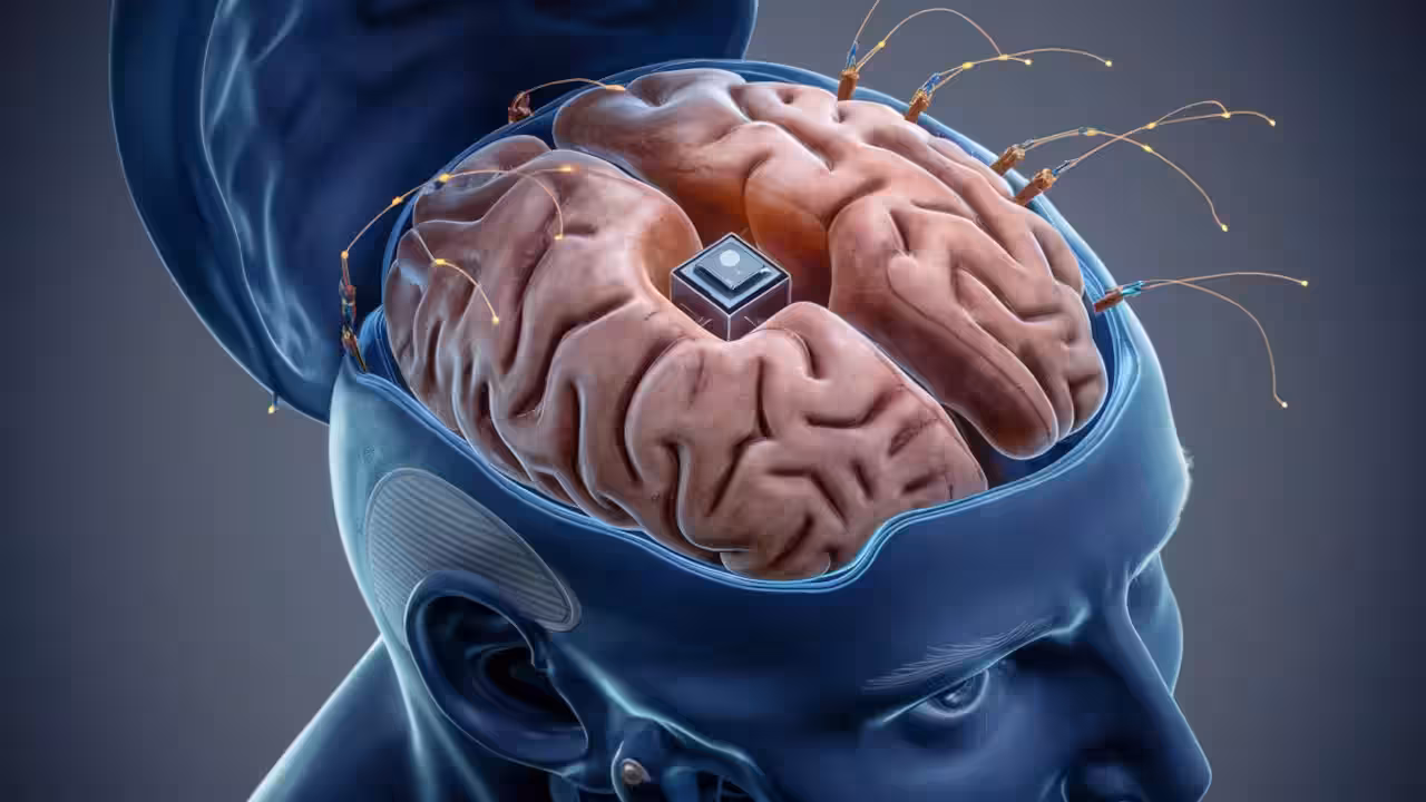brian implant ai gid 7