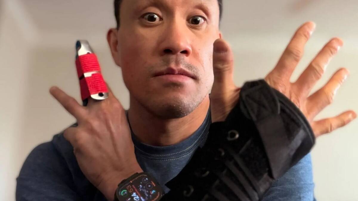 Apple Watch помогли спасти туриста после слепого падения с горы 3 65946 138221 phongleinjuries