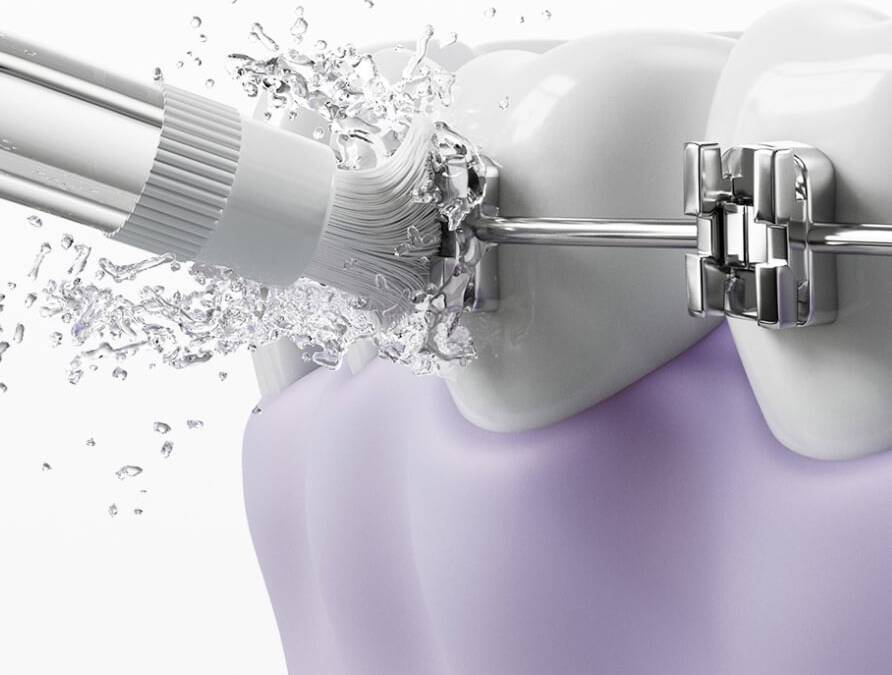 Ирригатор Xiaomi Mijia Smart Water Flosser Pro получил экран и 105 дней работы 3 Ирригатор Xiaomi Mijia Smart Water Flosser Pro в использовании вода брызгает
